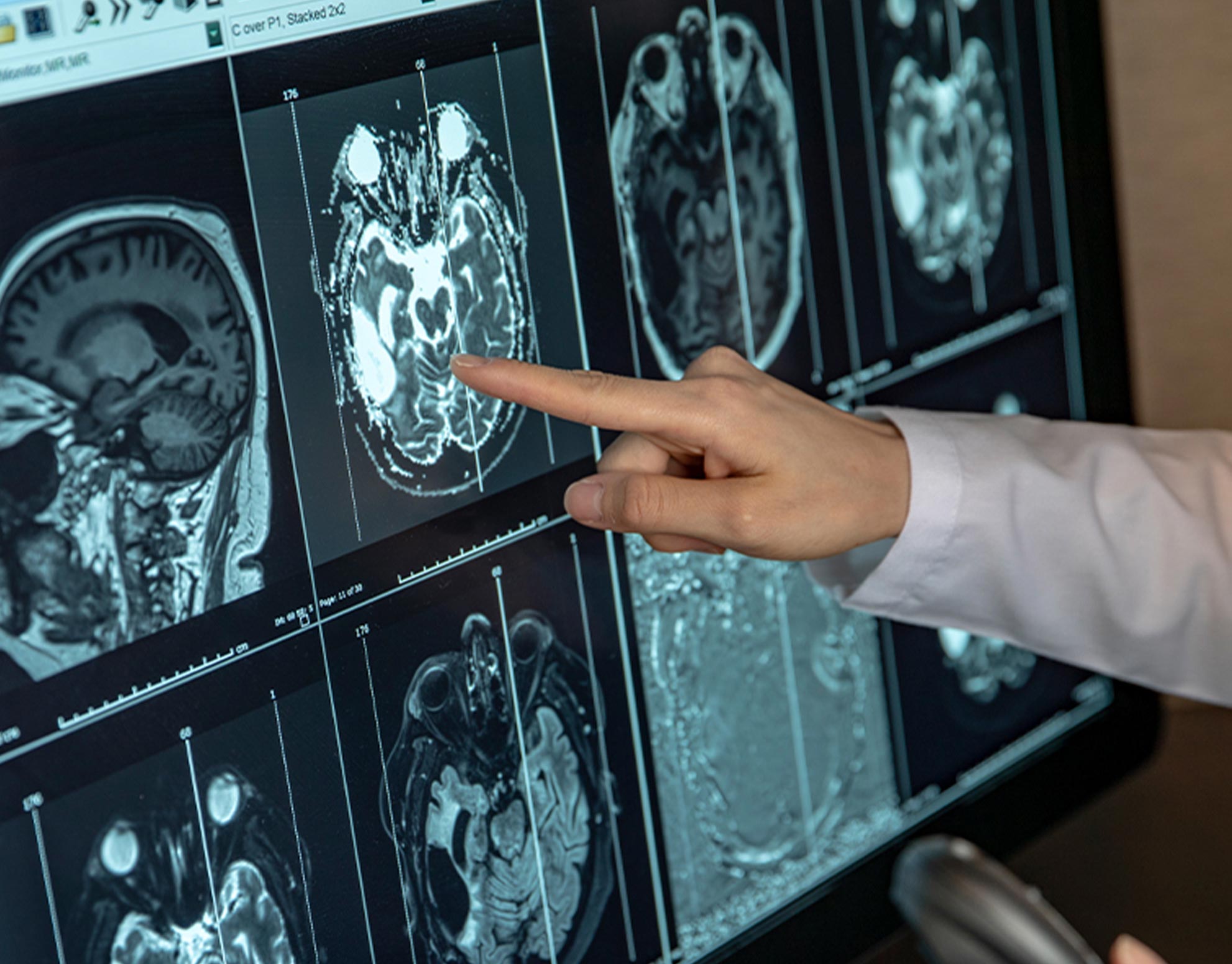 Diagnostic Imaging - The Role of Medical Imaging in Cancer Detection