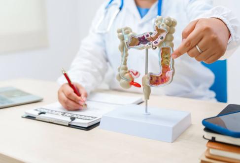 A doctor holds a human colon anatomy model, demonstrating the digestive system's structure to diagnose and treat various gastrointestinal diseases and conditions.